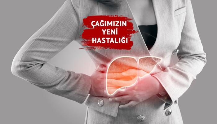 Çağın yeni hastalığı: Karaciğer yağlanması! Son 30-40 yılda giderek artıyor! Karaciğer yağlanması neden olur? Uzmanlardan uyarılar…