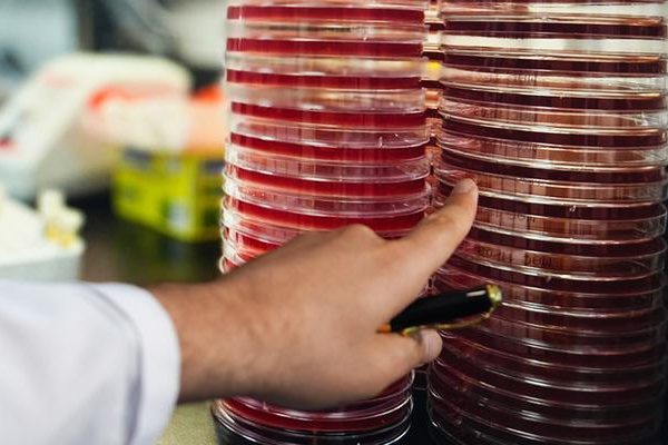 Göz mikropları uzaya taşındı: ‘Göz mikrobiyomu uzay ortamında incelendi’